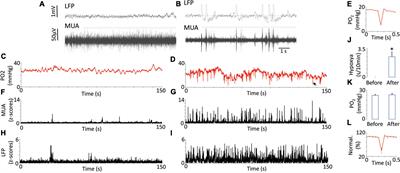 Brain tissue oxygen dynamics while mimicking the functional deficiency of interneurons